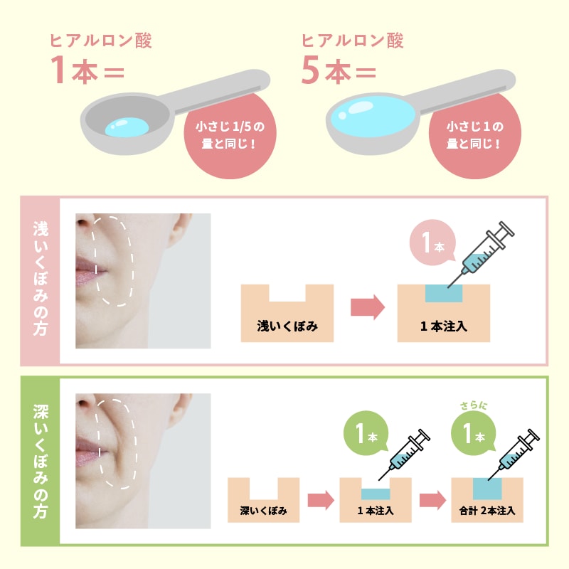 凹みの深さ・面積によって適切量が変わる