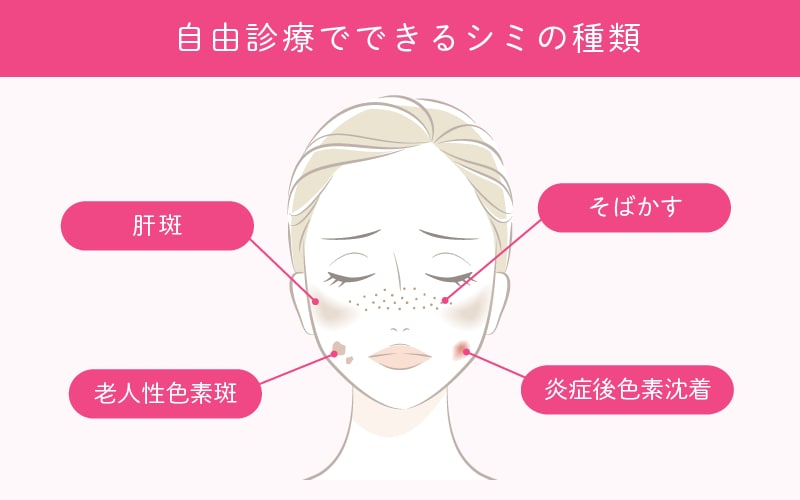 美容皮膚科でできるシミの種類