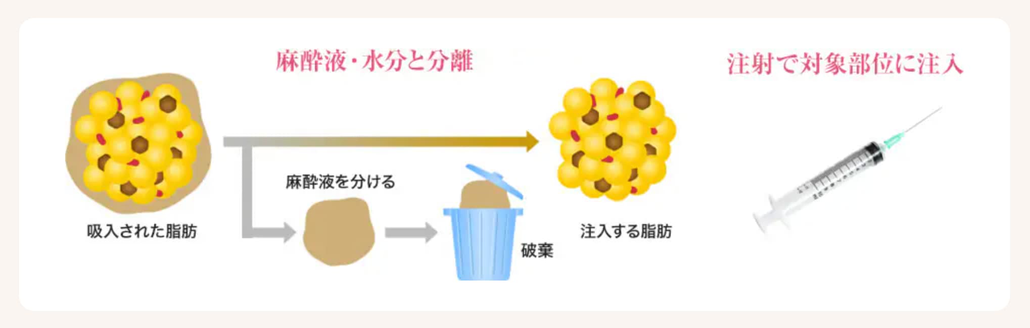 治療内容