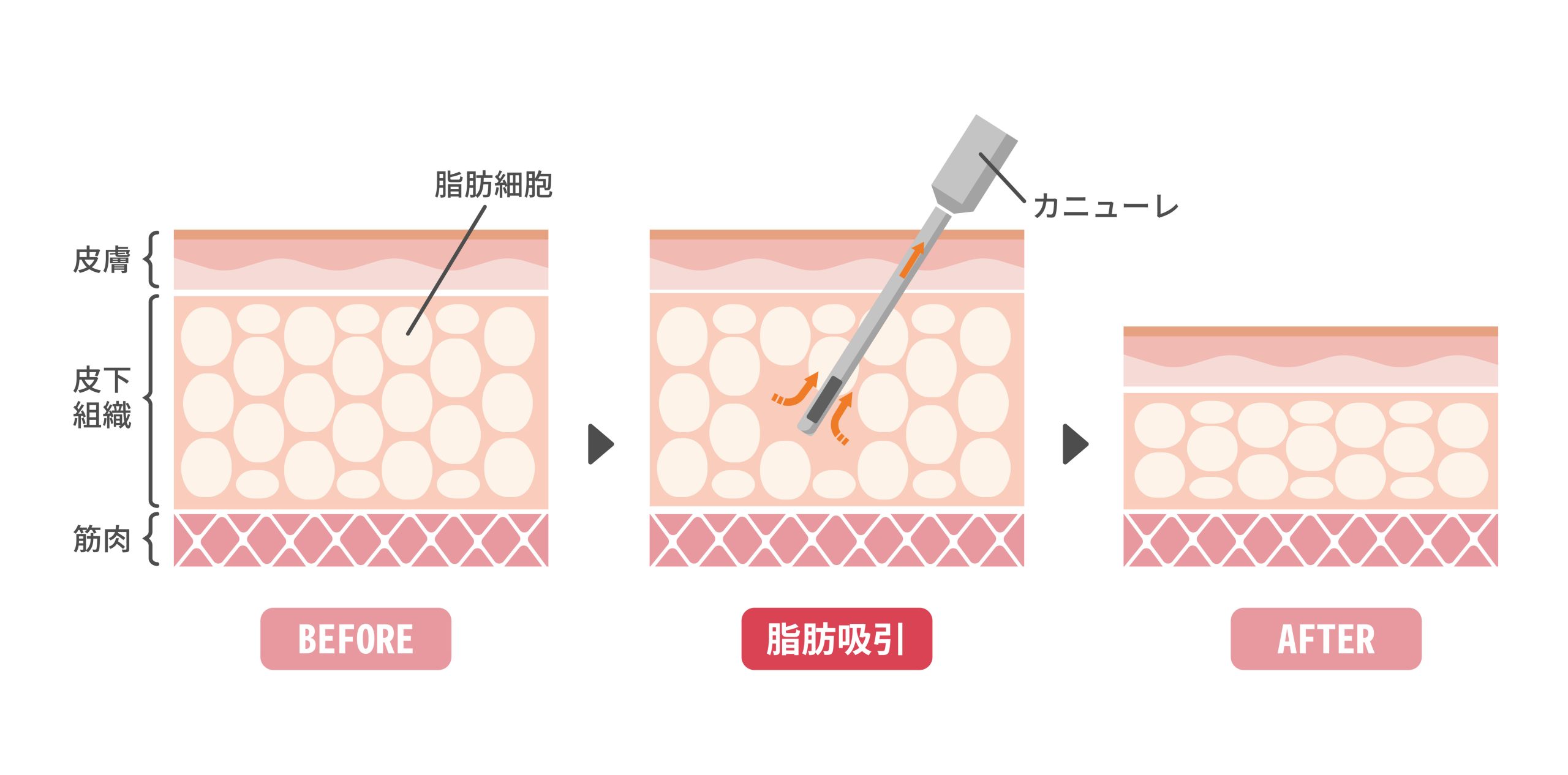 治療内容