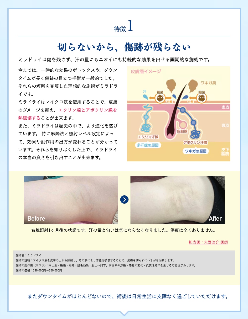 特徴1：切らないから、傷跡が残らない