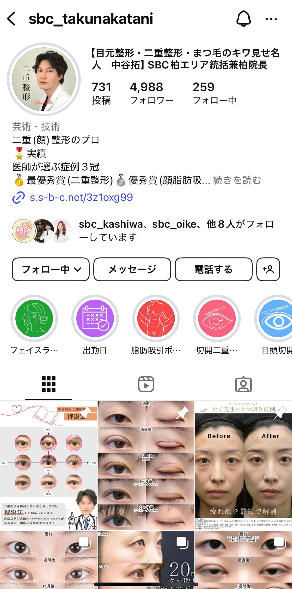 インスタグラムで症例写真をチェック