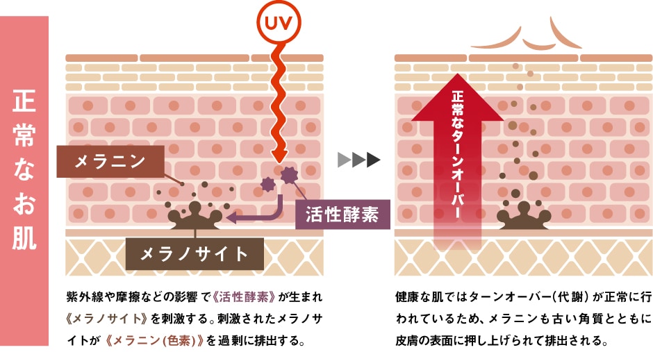 そもそもシミの原因って？