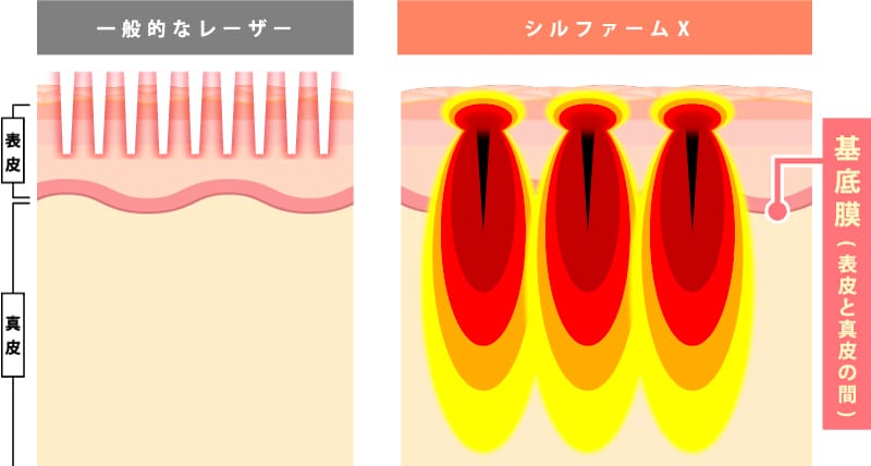 高精度なRF(高周波)出力機能