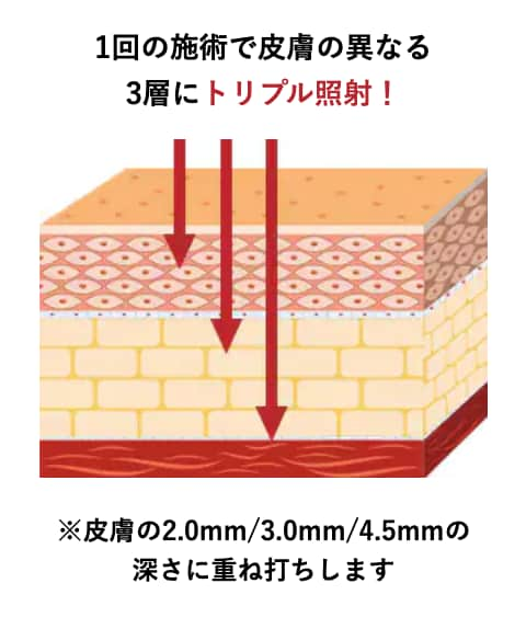 ウルトラセルQ +での最大ショット数に挑戦！<br />
