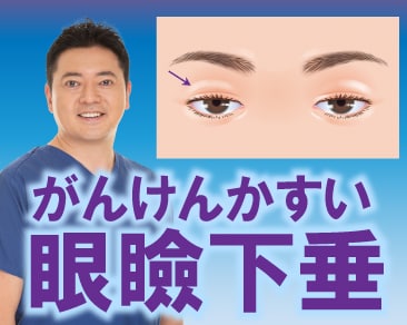 【まぶたが重い・下がる】切らない眼瞼下垂の手術をするなら関東の名医にお任せください✨【デカ目術】