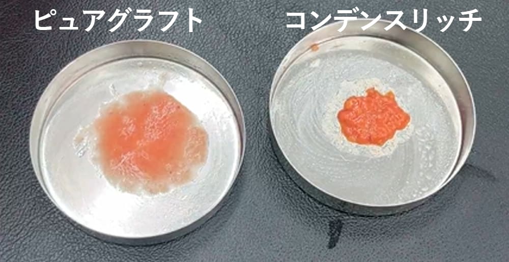 脂肪の質が成功のカギ！？術式によって脂肪の質がこんなに変わるんです