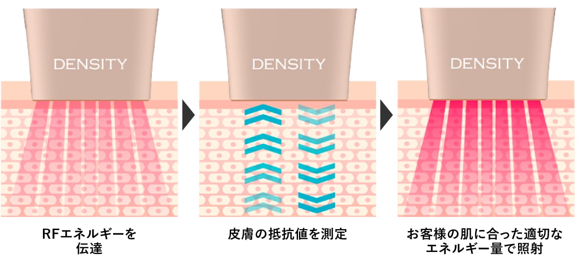 顔の脂肪が少ない方でも受けられる