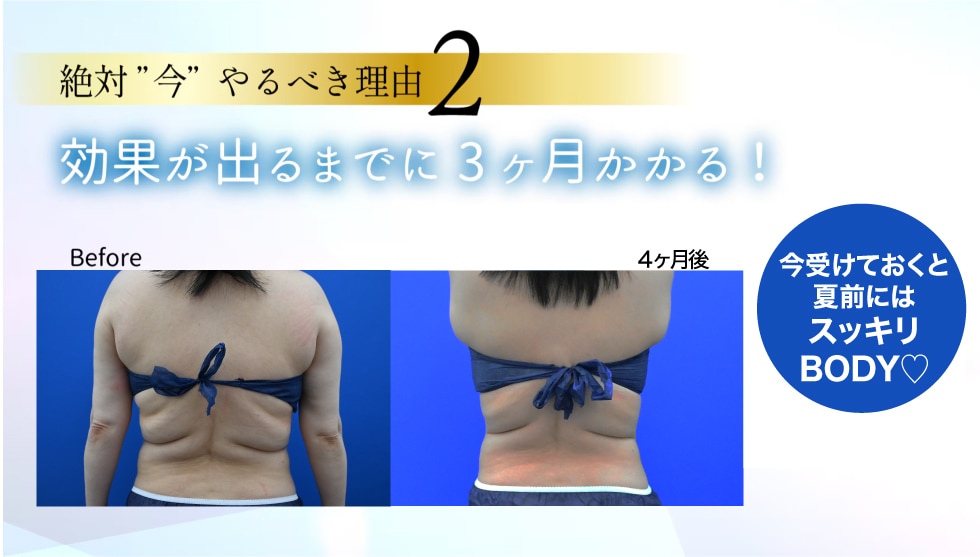 効果実感までに約3ヶ月程度