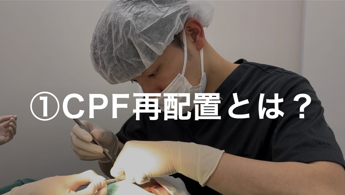 1.CPF再配置