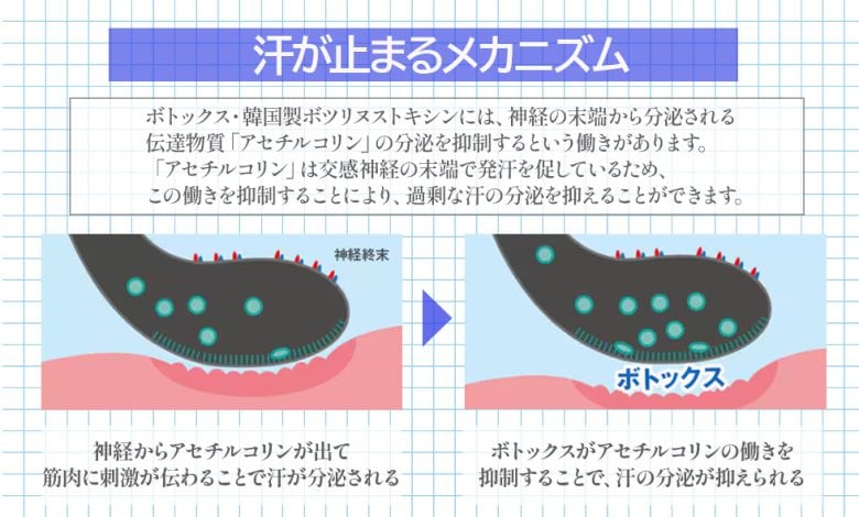 メカニズム