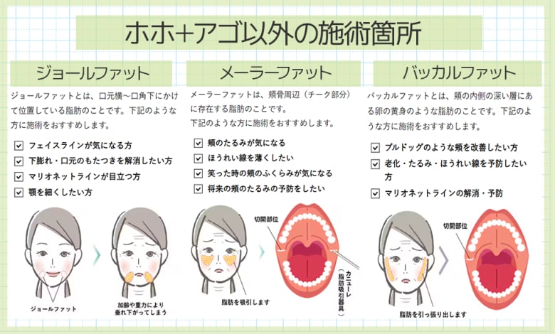 気になる顔の3大脂肪の撃退