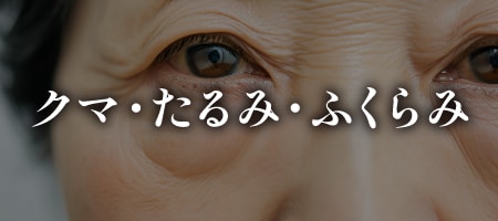 色クマだけがクマではない