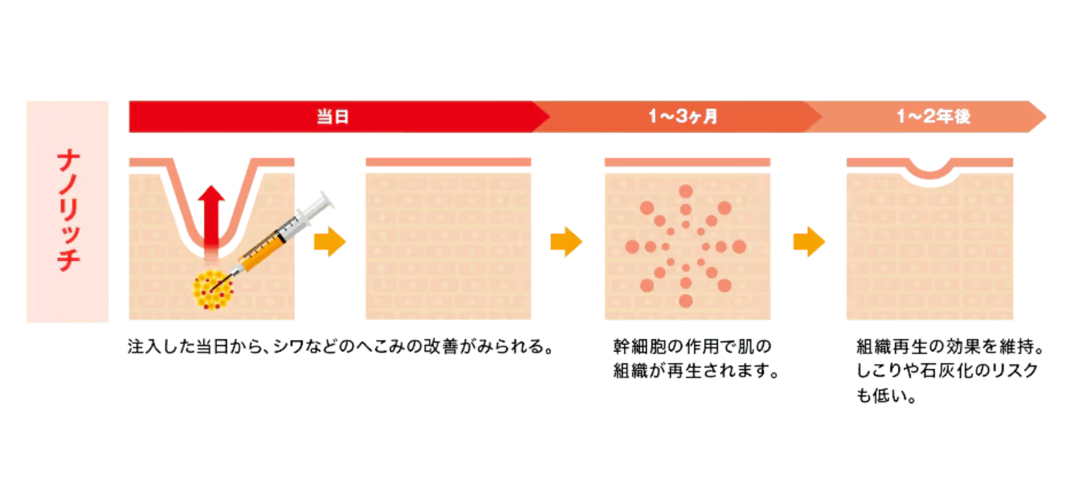 色味や細かいちりめんジワが気になるならナノリッチ