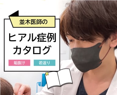 初めてでも安心！並木医師のヒアルロン酸！埼玉でお手軽に若返り・垢抜けならSBC熊谷院