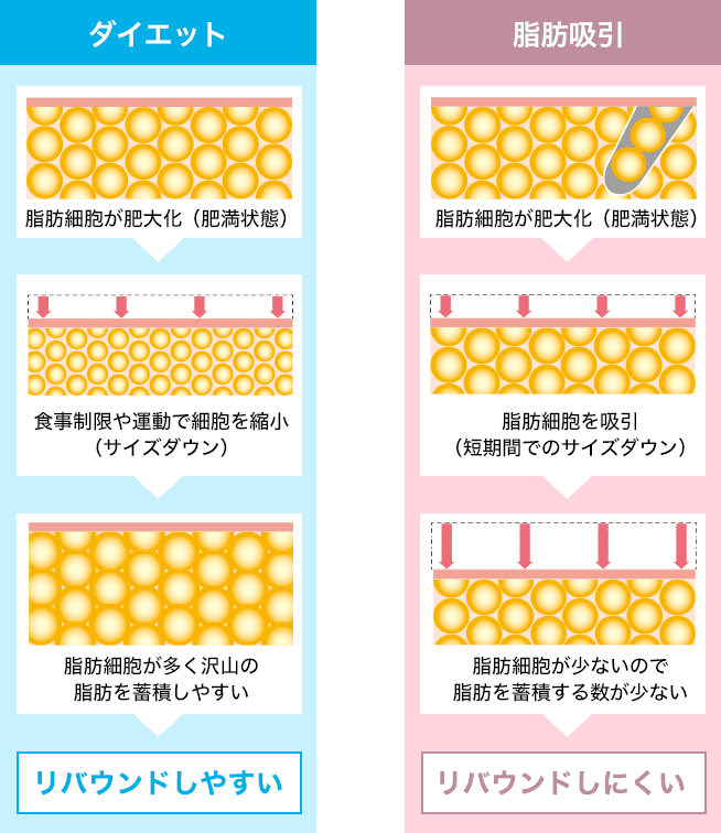 根こそぎとれるVASER脂肪吸引は、脂肪細胞にしか影響しない特殊な超音波<br />
「ベイザー波」を用いて、脂肪のみを乳化し、根こそぎ吸引する施術です。