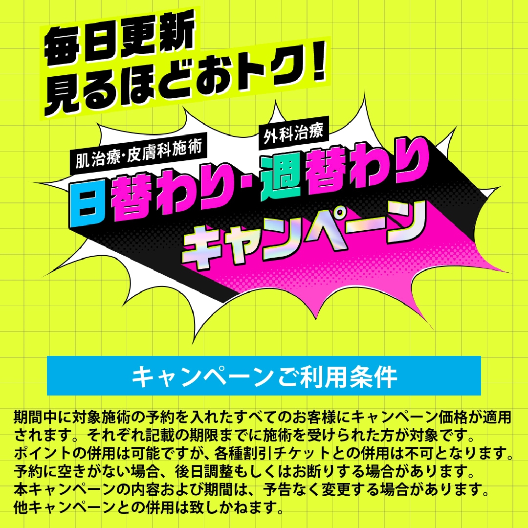 日替わり・週替わりキャンペーン始動！