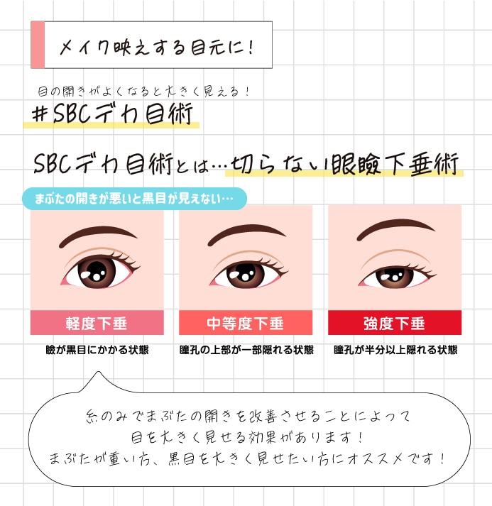 さらに目を大きく見せたい方に！SBCデカ目術