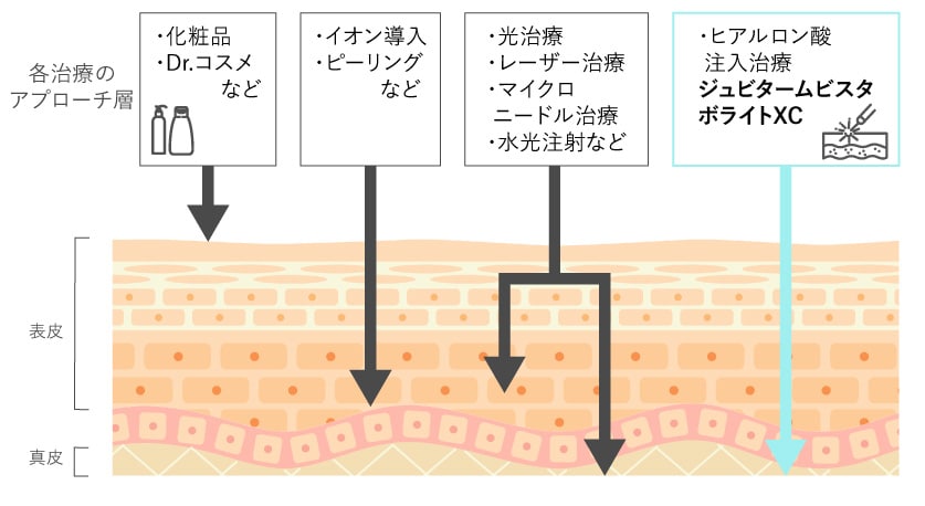 肌質改善で用いられている主な治療とは？