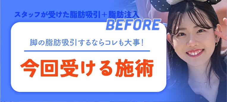 スタッフが選んだ施術は？