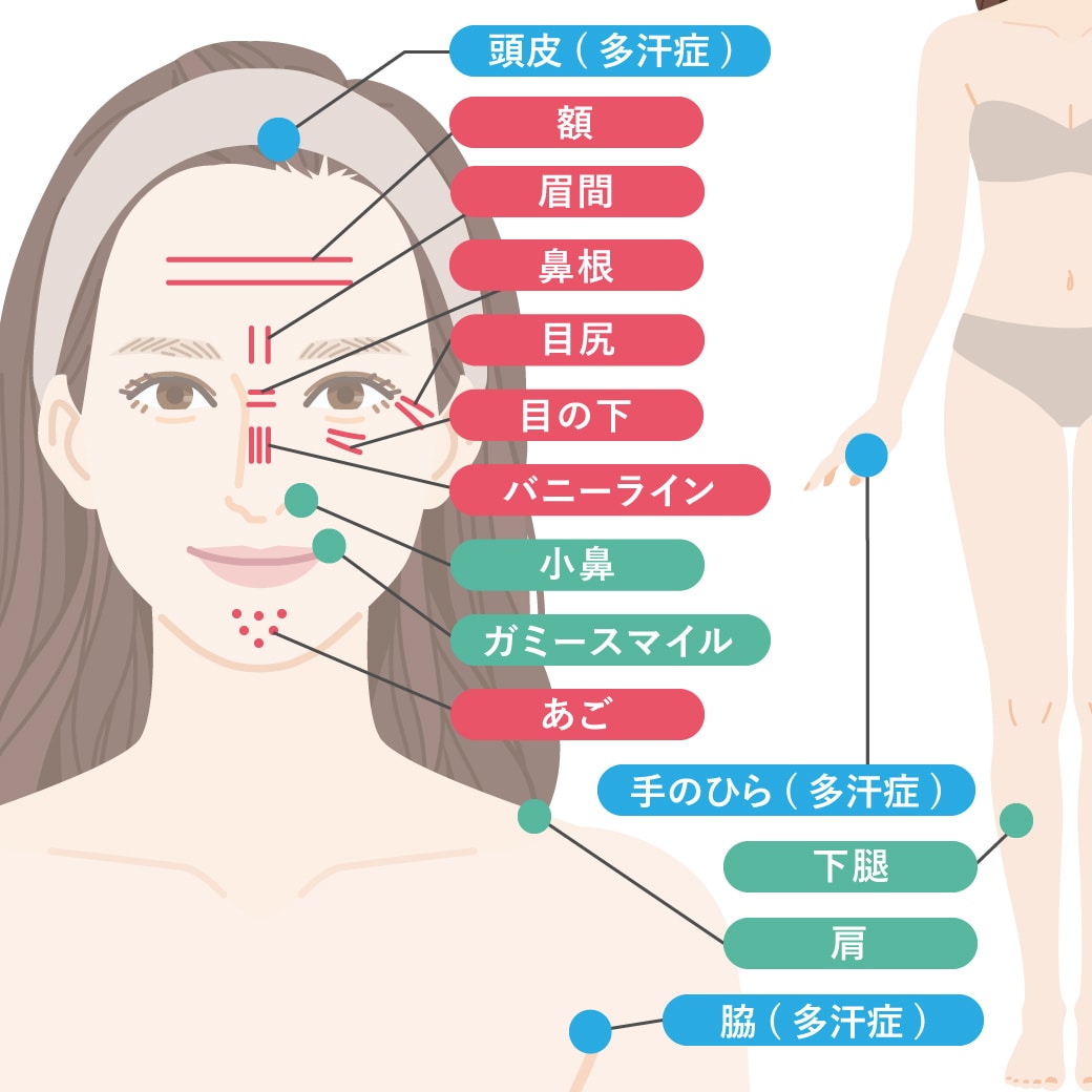 注射が打てる基本部位