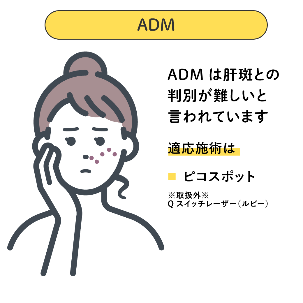 ADM（後天性真皮メラノサイトーシス）