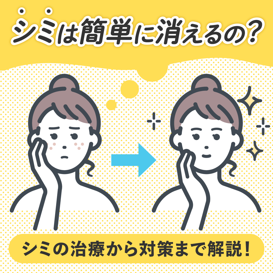 「シミは簡単に消える？」シミの治療方法から予防まで解説