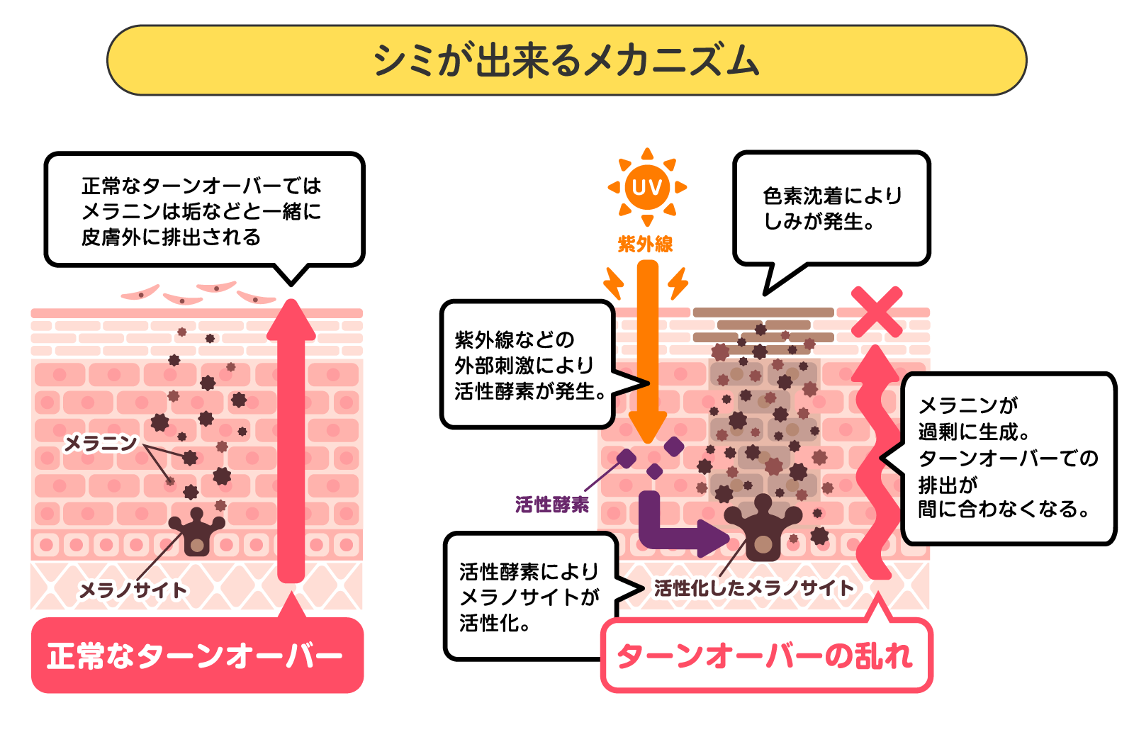 シミができる原因とメカニズムとは