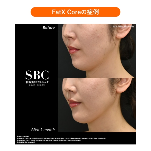 FatX Coreの症例写真