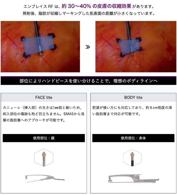 約30～40%の皮膚の収縮効果！