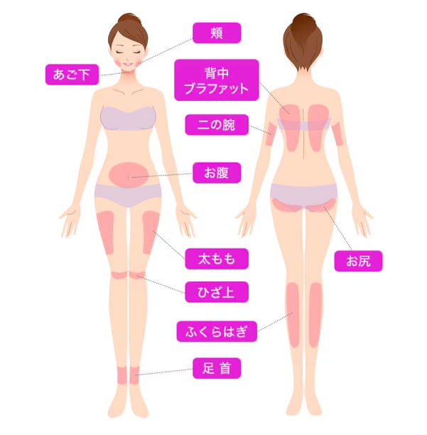 FatX Coreの適用部位は？