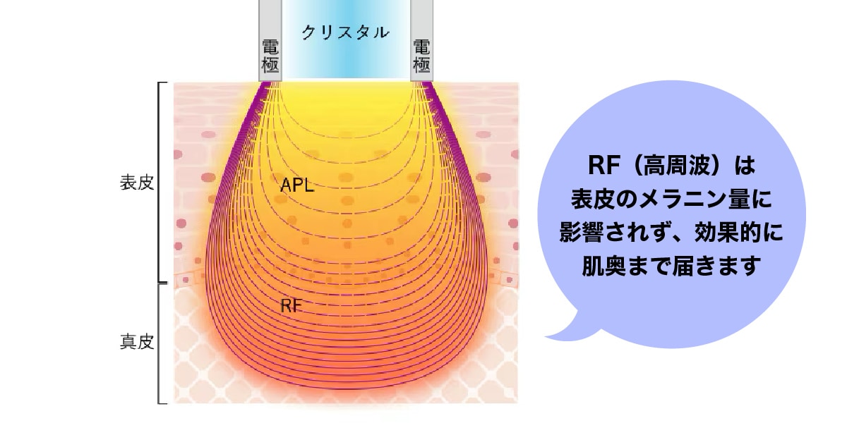 表皮のメラニン量に影響されない