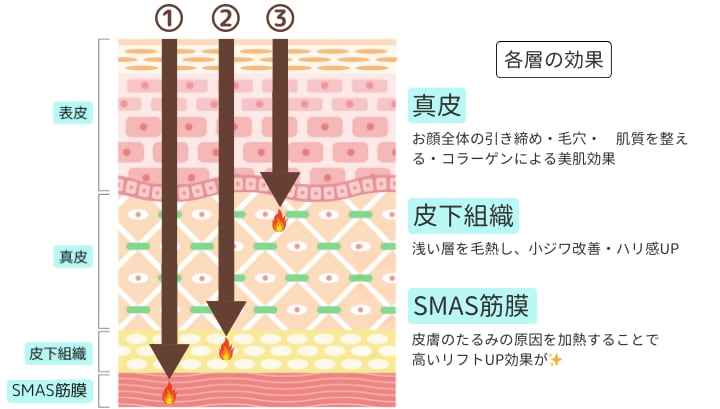 皮膚の浅い層〜深い層まで届く超音波！