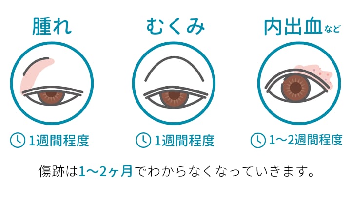 ダウンタイムの症状と期間