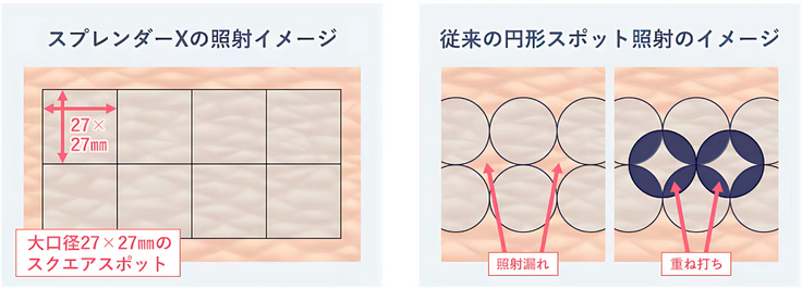 世界初！？大口径27×27㎜のスクエアスポット！