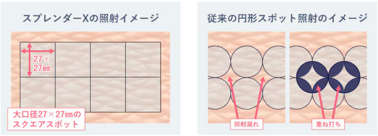 世界初！？大口径27×27㎜のスクエアスポット！