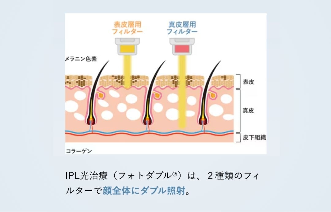 フォトダブルってなに？