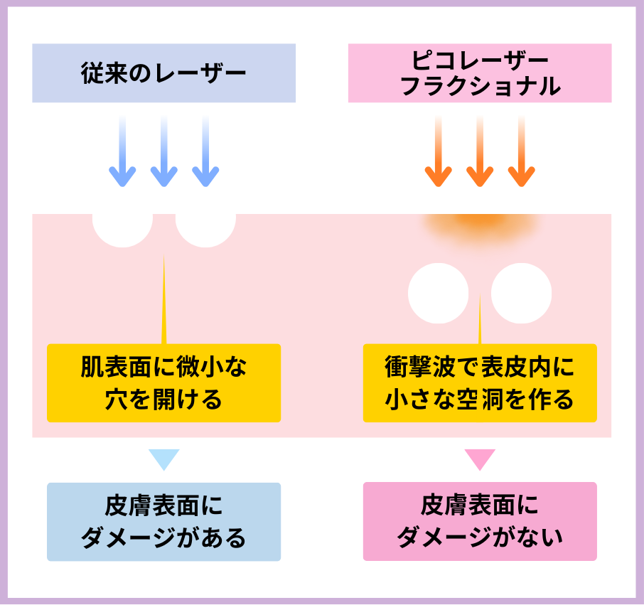 毛穴改善でハリのあるお肌に！