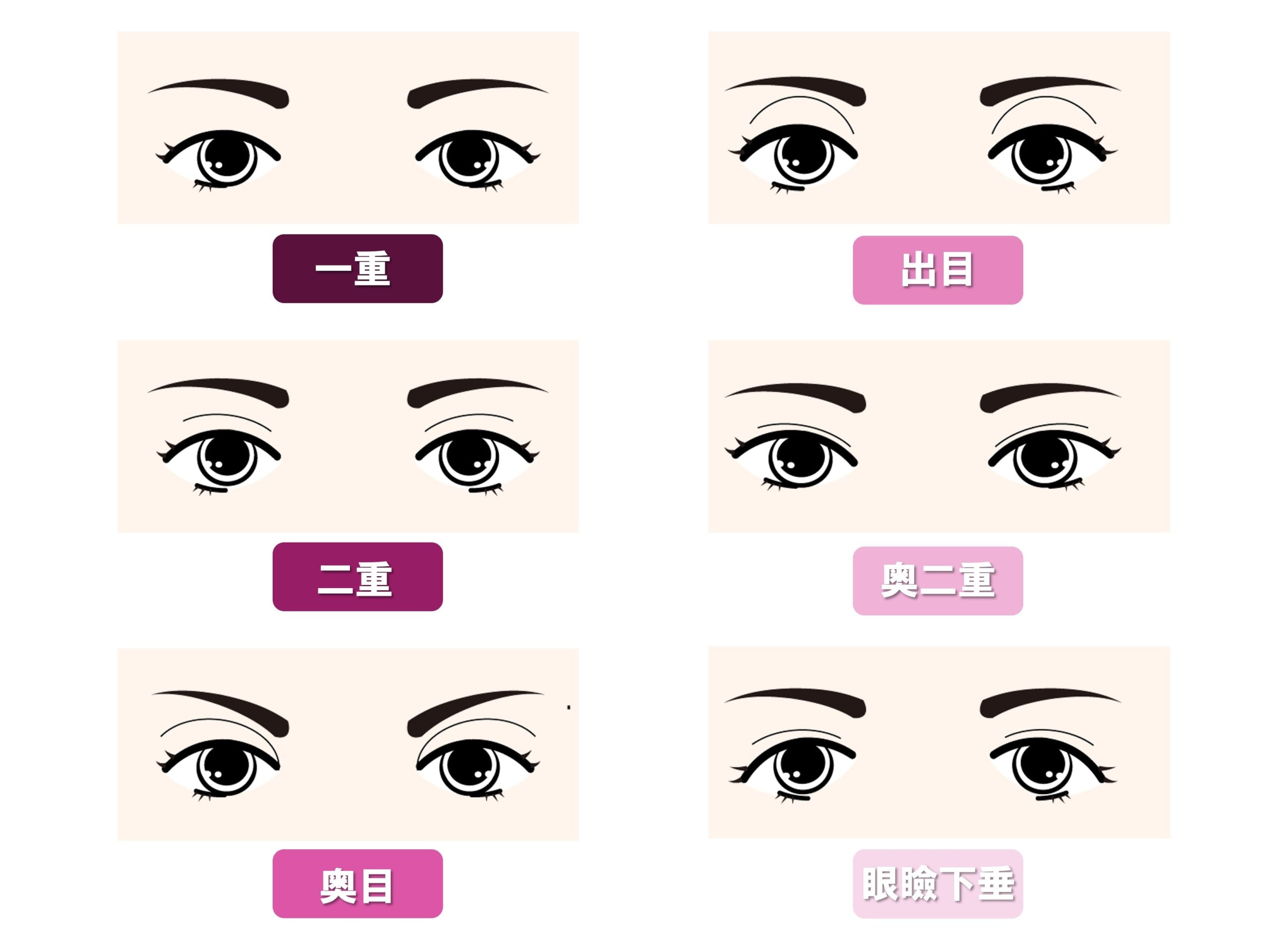 16,000件を超える圧倒的な症例数で培った【二重タイプ】