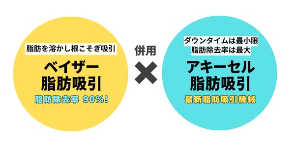 機械選びが重要！