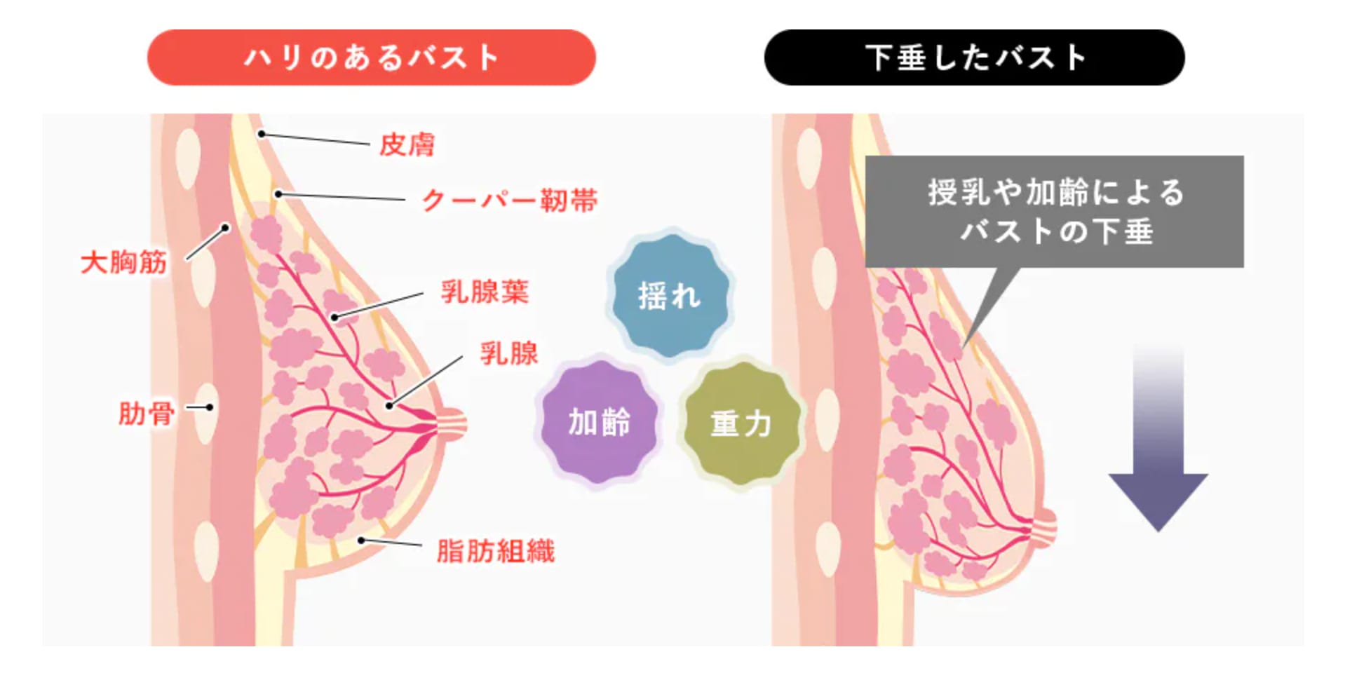 産後に胸が垂れる原因は？