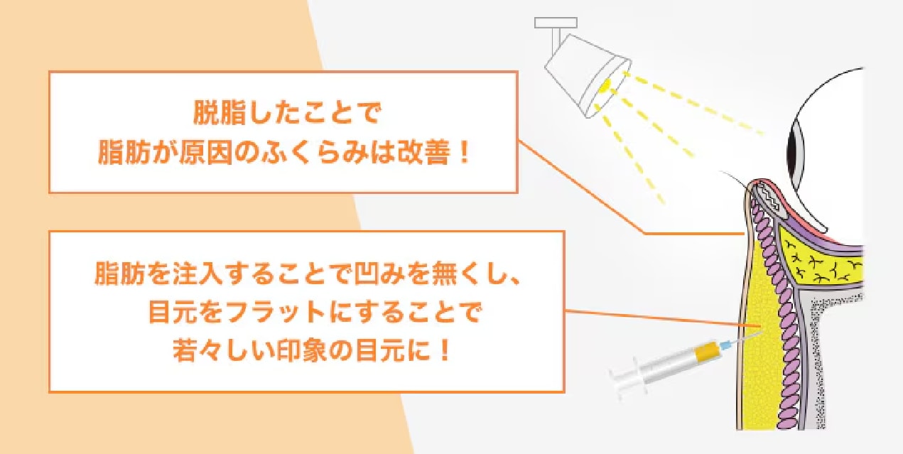 「影をなくす」目元全体の影も改善できる！