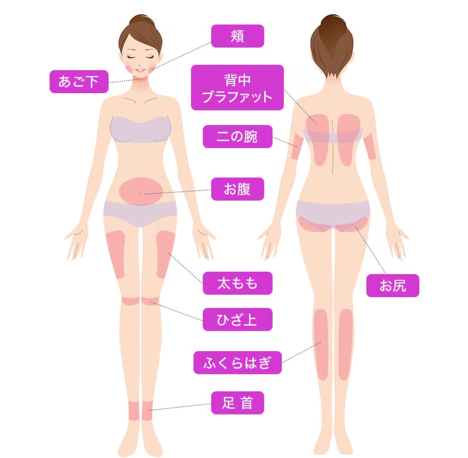 対応部位についてとおすすめ