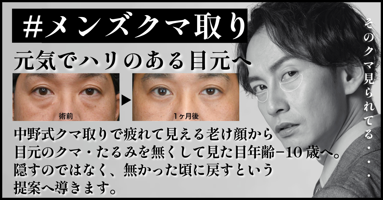 【男性必見！】疲れ顔＆老け顔を解消するメンズクマ取り！名古屋の名医 中野達生が徹底解説します！