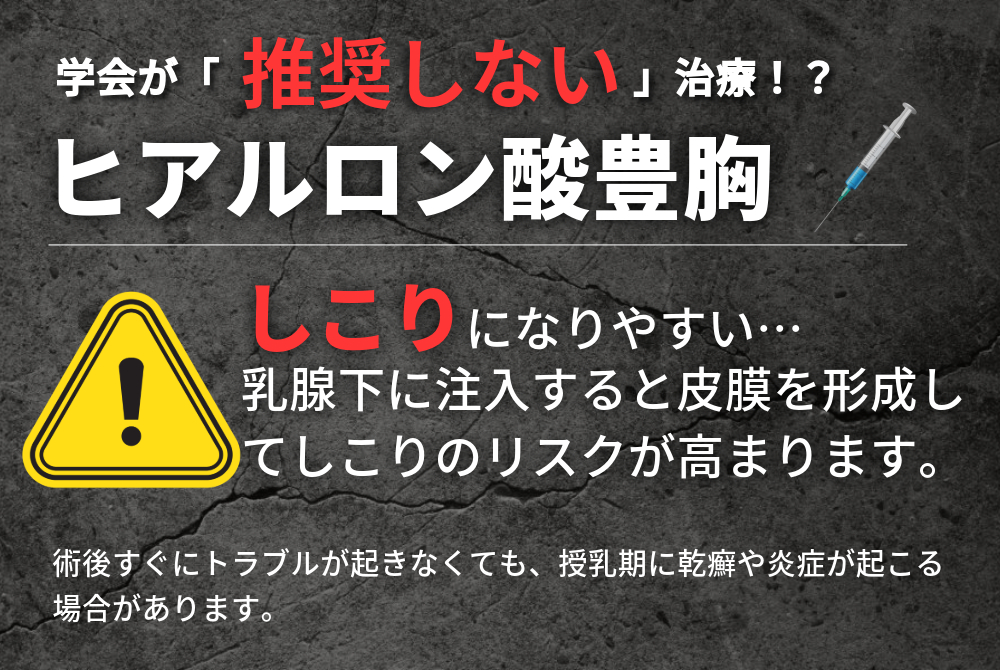 ヒアルロン酸豊胸のしこりリスクとは？