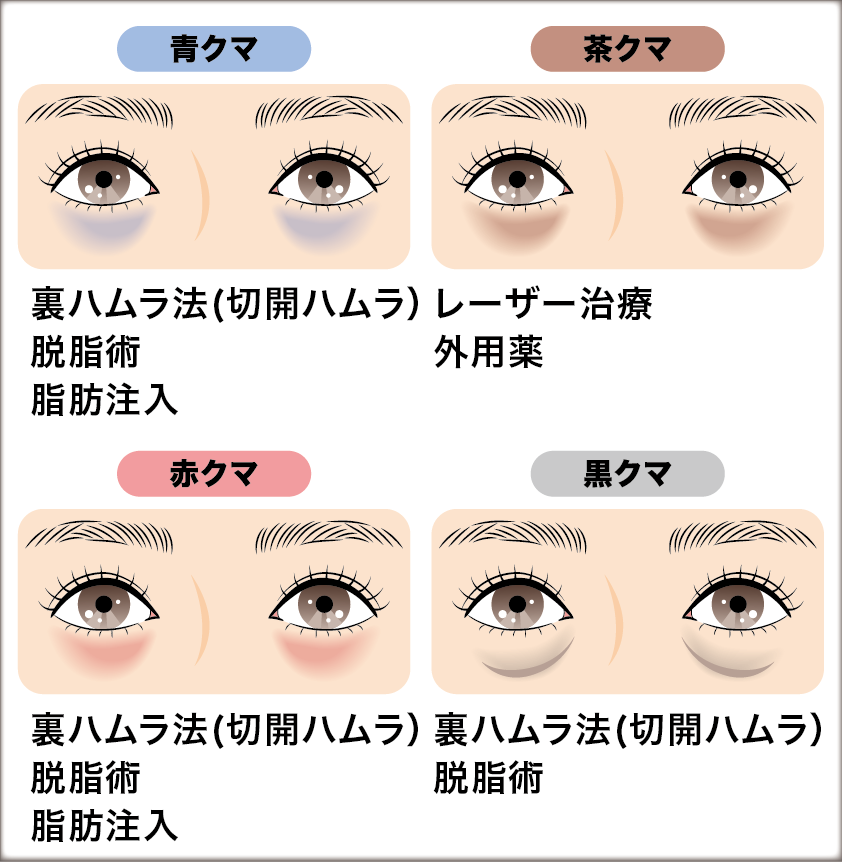 あなたの症状や悩みに合った治療法を選ぶ