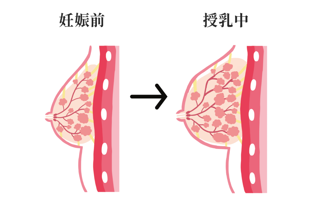 シリコンバック豊胸の注意点 