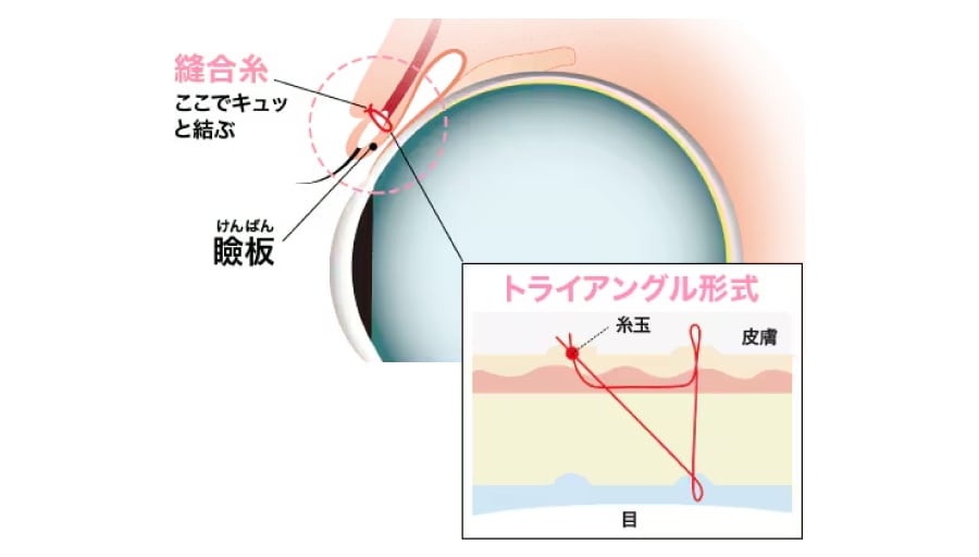 週末二重®とは