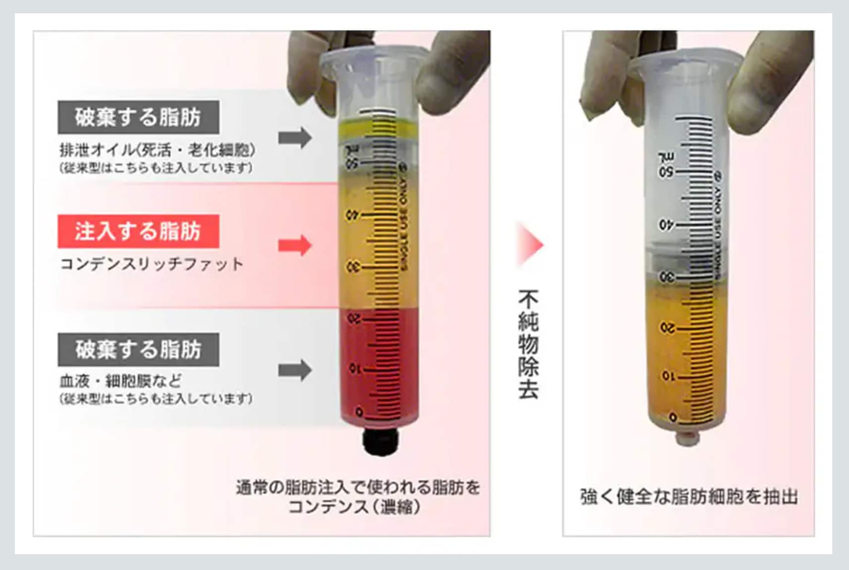 Point.3 空気に触れないプロセス✨