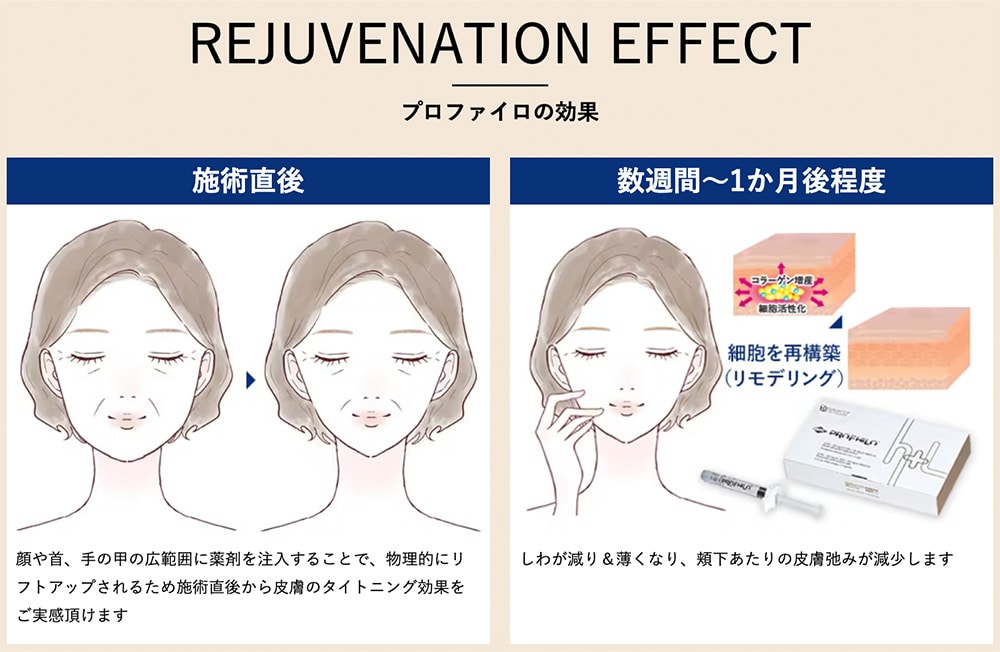 数週間～1か月後程で馴染んで変わっていく！